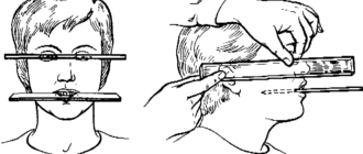 Методы определения центрального соотношения челюстей