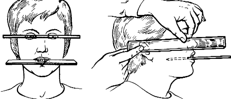 Методы определения центрального соотношения челюстей