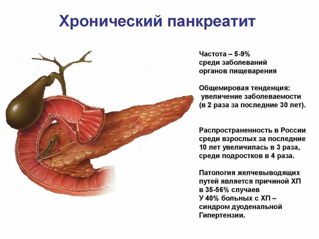 Понимание панкреатита: симптомы, причины и лечение