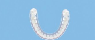 Retainers: Why They're Crucial for Your Dental Health and Smile