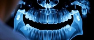 Dental X-rays: Safety and Necessity Explained for Every Patient