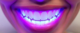 LED Teeth Whitening: Does It Really Work?