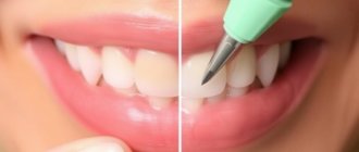 Tooth Reshaping: Quick Cosmetic Fix to Enhance Your Smile