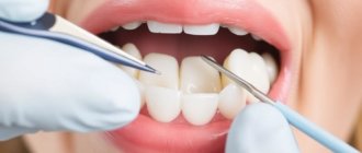 Fixing Gaps Between Teeth: Your Complete Guide to a Confident Smile