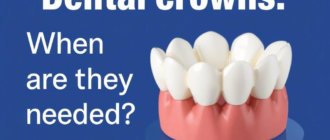Dental Crowns: When Are They Needed and How Do They Help?