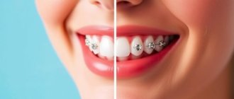 Invisalign vs. Traditional Braces: Which Is the Best Choice for Your Perfect Smile?