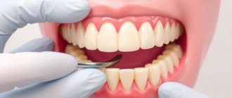 Gum Graft Surgery Explained: A Comprehensive Guide to Healthier Gums