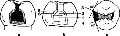 Принципы и техника препарирования твердых тканей зуба при кариесе