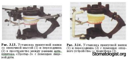 Основные типы артикуляторов. 