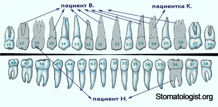 Анатомическое строение зубов