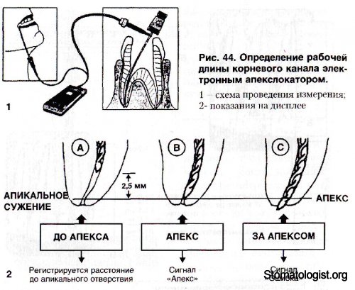 ИНСТРУМЕНТАЛЬНАЯ И МЕДИКАМЕНТОЗНАЯ ОБРАБОТКА КОРНЕВЫХ КАНАЛОВ