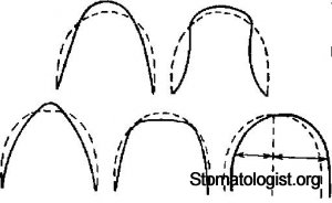 АНОМАЛИИ ФОРМЫ И ВЕЛИЧИНЫ ЗУБНЫХ ДУГ