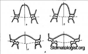 АНОМАЛИИ ФОРМЫ И ВЕЛИЧИНЫ ЗУБНЫХ ДУГ