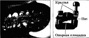 АППАРАТЫ МЕХАНИЧЕСКОГО ДЕЙСТВИЯ (АКТИВНЫЕ)