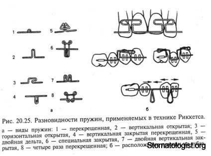 Выбор длины ни тиноловой дуги. 