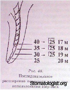 ПРЕПАРИРОВАНИЕ КОРНЕВОЙ ПОЛОСТИ ЗУБА