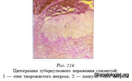 СПЕЦИФИЧЕСКИЕ ИНФЕКЦИИ