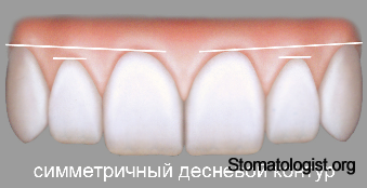 Розовая эстетика